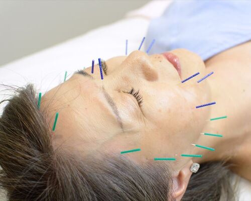 EB66237B-EB30-4A81-A2A5-3FA9C305C9CD